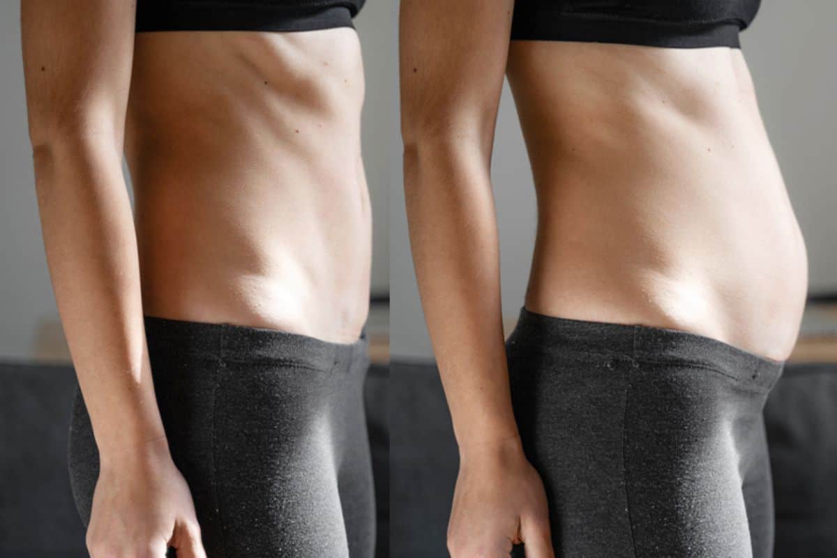 How long does diastasis recti take to improve Grimsby?