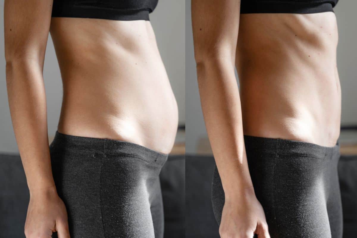 Post-Pregnancy: What Happens to Your Abdominal Muscles After Birth Grimsby