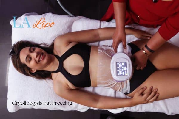 woman getting cryolipolysis Grimsby