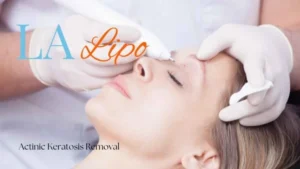 Woman receiving Actinic Keratosis Removal Treatment Grimsby
