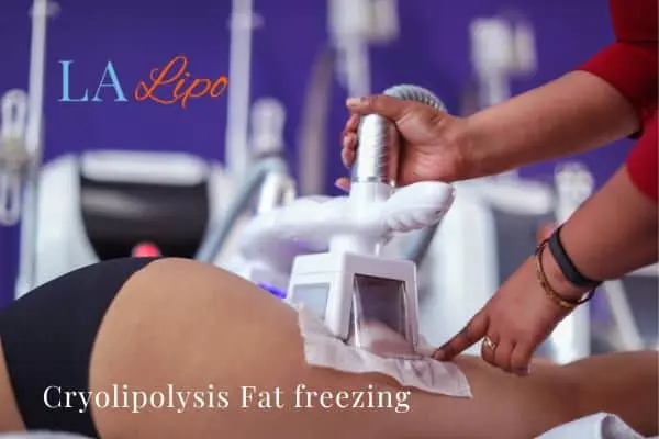 women getting fat freezing Grimsby