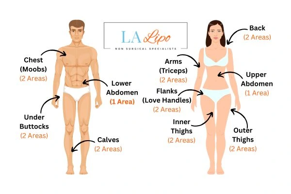 LA LIPO Cryolipolysis Areas Grimsby